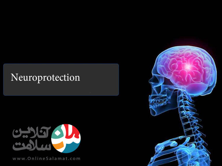 Neuroprotection در شبکیه